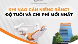 [Tìm hiểu] Khi nào cần niềng răng? Độ tuổi và chi phí mới nhất