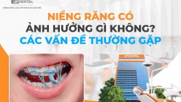 Niềng răng có ảnh hưởng gì không? Các vấn đề thường gặp