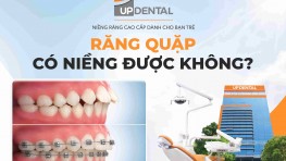 Răng quặp có niềng được không?