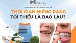 Thời gian niềng răng tối thiểu là bao lâu?