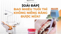 [Giải đáp] Bao nhiêu tuổi thì không niềng răng được nữa?