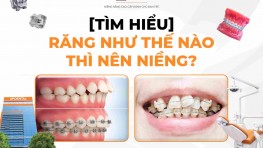 [Tìm hiểu] Răng như thế nào thì nên niềng?