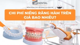 Chi phí niềng răng hàm trên giá bao nhiêu [2026]