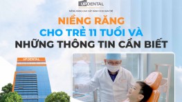 Niềng răng cho trẻ 11 tuổi và những thông tin cần biết