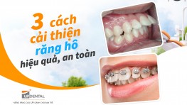 3 cách cải thiện răng hô hiệu quả, an toàn