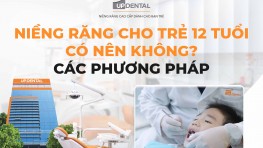 Niềng răng cho trẻ 12 tuổi có nên không? Các phương pháp