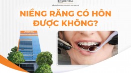[Giải đáp] Niềng răng có hôn được không?