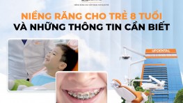 Niềng răng cho trẻ 8 tuổi và những thông tin cần biết