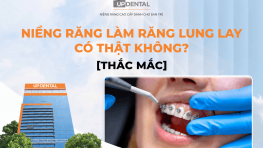 Niềng răng làm răng lung lay có thật không? [Thắc mắc]