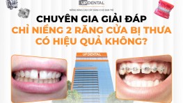 Chuyên gia giải đáp: Chỉ niềng 2 răng cửa bị thưa có hiệu quả không?