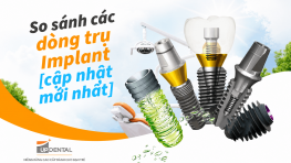 So sánh các dòng trụ Implant [cập nhật mới nhất]