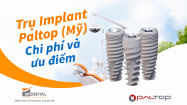 Trụ Implant Paltop (Mỹ) - Chi phí và ưu điểm