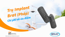 Trụ Implant Brat (Pháp) - Chi phí và ưu điểm