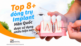 Top 8+ dòng trụ Implant Hàn Quốc được sử dụng nhiều hiện nay