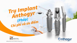 Trụ Implant Anthogyr (Pháp) - Chi phí và ưu điểm