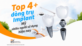 Top 4+ dòng trụ Implant Mỹ nhiều người sử dụng hiện nay