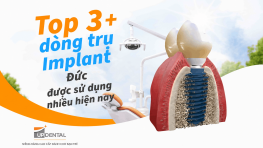 Top 3+ dòng trụ Implant Đức được sử dụng nhiều hiện nay