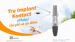 Trụ Implant Kontact (Pháp) - Chi phí và ưu điểm