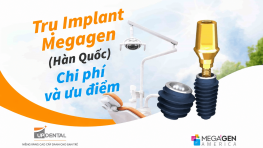 Trụ Implant Megagen (Hàn Quốc) - Chi phí và ưu điểm
