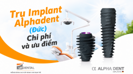 Trụ Implant Alphadent (Đức) - Chi phí và ưu điểm