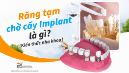 Răng tạm chờ cấy Implant là gì? [Kiến thức nha khoa]
