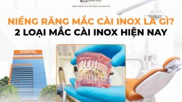 [Tìm hiểu] Niềng răng mắc cài inox là gì? 2 loại mắc cài inox hiện nay