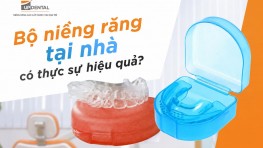 [Thắc mắc] Bộ niềng răng tại nhà có thực sự hiệu quả?