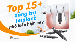 Top 15+ dòng trụ Implant phổ biến hiện nay