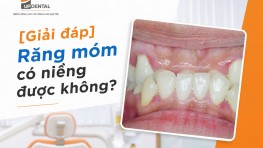 [Giải đáp] Răng móm có niềng được không?