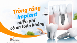 Trồng răng Implant miễn phí có an toàn không