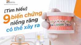 [Tìm hiểu] 9 biến chứng niềng răng có thể xảy ra