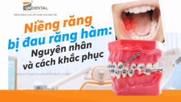 Niềng răng bị đau răng hàm: Nguyên nhân và cách khắc phục