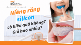 Niềng răng silicon có hiệu quả không? Giá bao nhiêu?